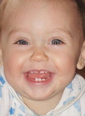 інтервю з дитячим стоматологом: валентина вольхина : бережіть зуби дитини з моменту його зачаття